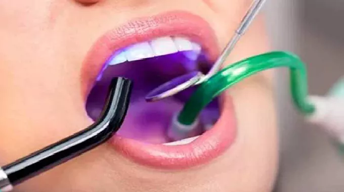 ساکشن دندان پزشکی